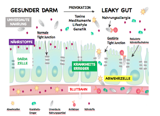 Naturheilpraxis Yvonne Guretzka - Darm-Dysbiose/ Leaky Gut